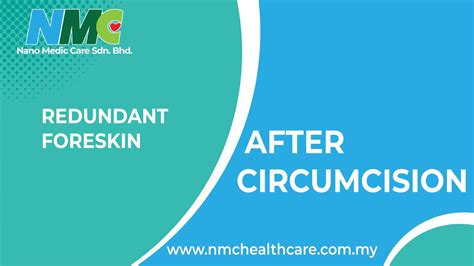 Redundant Foreskin After Circumcision Nano Medic Care