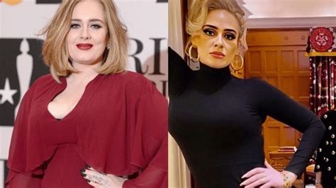 Did Adele Have Weight Loss Surgery 100 Pounds Cardiologist Explains