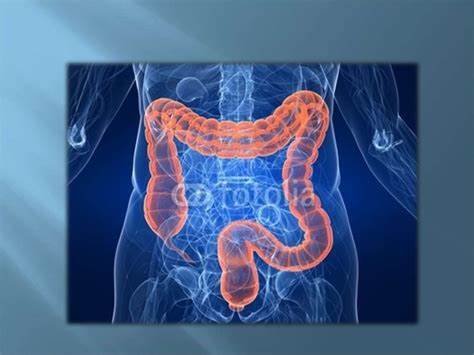 Толстый кишечник. Брюшина - online presentation Картинка - Толстый кишечник. Брюшина - online presentation