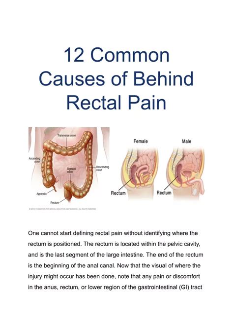 PPT Common Causes Of Behind Rectal Pain PowerPoint Presentation Free Download ID