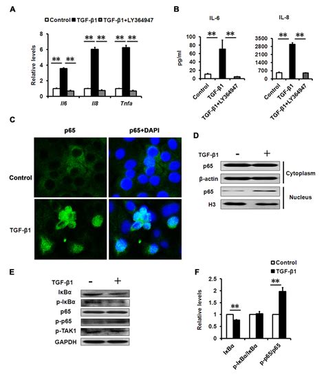 TGF β and NF κB signaling pathway crosstalk potentiates corneal