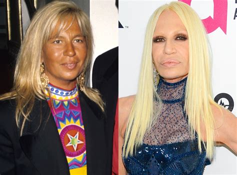 Donatella Versace From Face Changes That Shocked The World E News