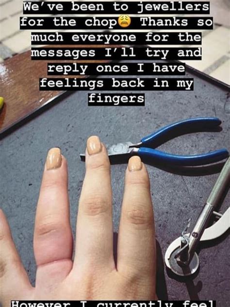 Woman Has 898k Engagement Ring Cut Off Her Swollen Finger