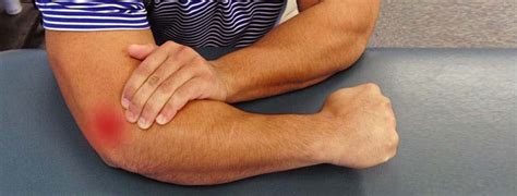 Elbow Physical Therapy Treatments Atlantic Physical Therapy