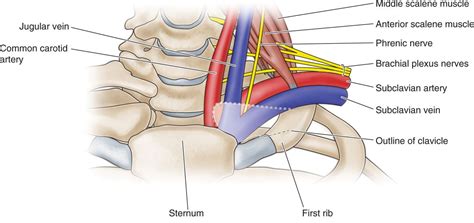 Supraclavicular And Infraclavicular Nerve Blocks Anesthesia Key