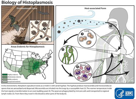 Histoplasmosis Causes Symptoms Diagnosis Prognosis Treatment