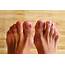 Cures For Thick Yellow Toenails  Healthfully