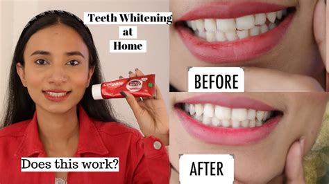 How To Get The Perfect Smile My Teeth Whitening Secret Revealed Youtube