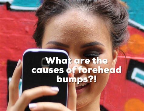 Overview Of A Bumpy Forehead — Liz Claire Bumpy Forehead Forehead