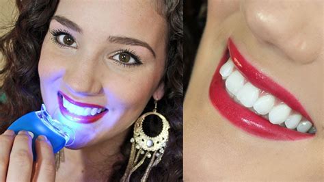 Affordable Effective Teeth Whitening Smile Bright Review Youtube