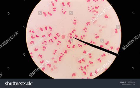 Diplococcus Bacteria