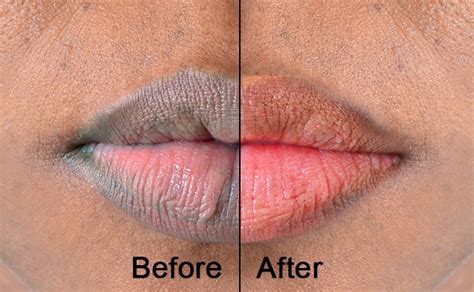 13 Home Remedies To Get Pink And Soft Lips Fast Best