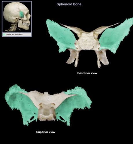 Sphenoid Bone Superior And Posterior View Flashcards Quizlet