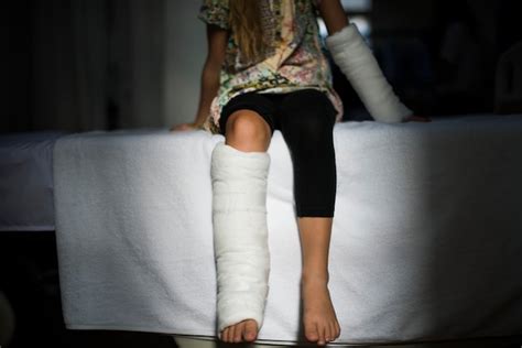 Free Photo Young Caucasian Girl With Broken Leg In Plaster Cast