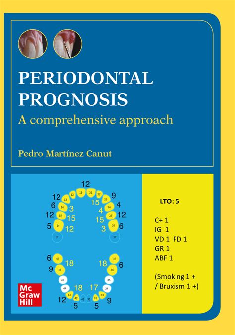Periodontal Prognosis A Comprehensive Approach Digital Book