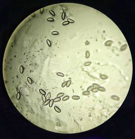 Pinworm Under Microscope