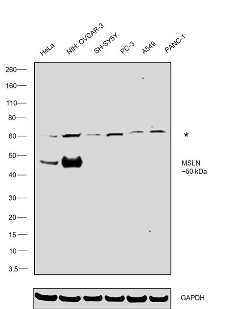 Mesothelin Polyclonal Antibody Pa5 21662