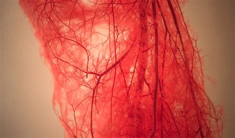 Racgp Do Childrens Healthy Blood Vessels Protect Them From Severe