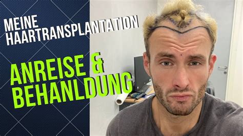 Mein Neues Ich Haartransplantation In Istanbul Anreise Behandlung