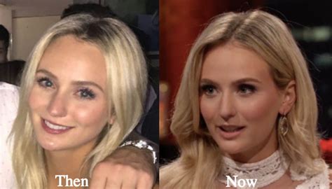 Lauren Bushnell Plastic Surgery Before And After Photos Latest