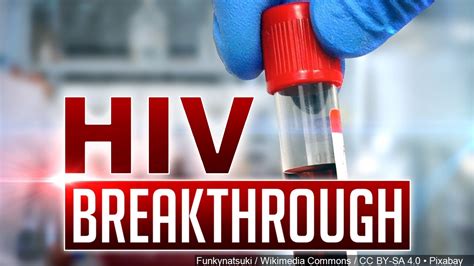 Company Says They Believe They Have The Cure For Hivaids