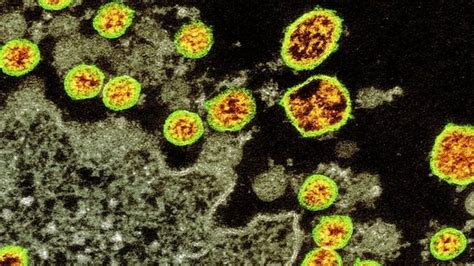 Coronavirus Fake News Is Spreading Fast Bbc News
