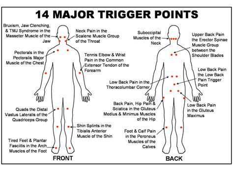 Major Trigger Points Almawi Limited The Holistic Clinic