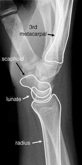 An X Ray View Of The Knee Showing Different Parts