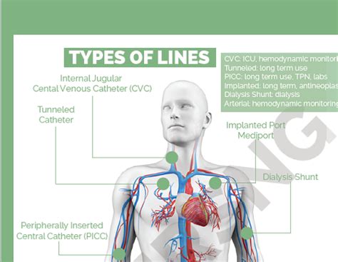 Central Venous Catheters Central Lines Cheat Sheet