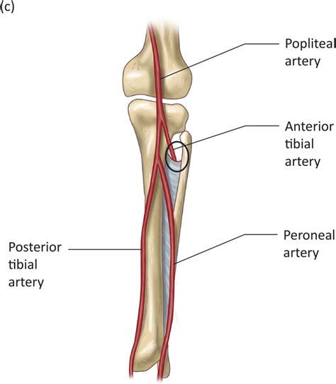 Chapter 41 Popliteal Vessels Anesthesia Key