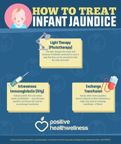 How To Treat Infant Jaundice Infographic Positive Health Wellness