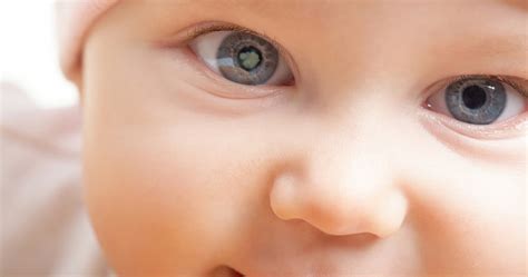 What Is Congenital Cataract And When Should The Infant Have The Surgery