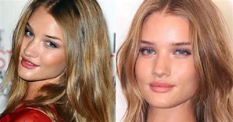 Rosie Huntington Whiteley Nose Job Plastic Surgery Before And After