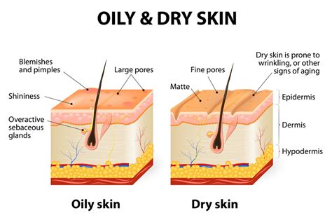 Targeting The Cause Of Dry Damaged Skin Latest Skincare News From