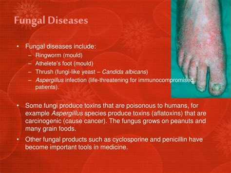 Types Of Fungal Diseases