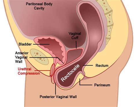 Blasen Zwischen Vagina Und Anus Nackte M Dchen Und Ihre Muschis