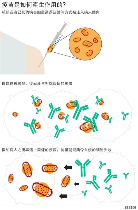 疫苗簡史：治病救人的它緣何受到質疑 Bbc News 中文