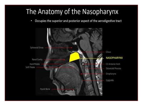 Nasopharynx Ct Scan Anatomy Ct Scan Machine