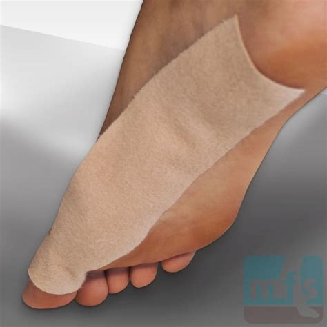 Turf toe describes an injury to the bottom surface of the big toe joint, known as the plantar in the immediate stage after a turf toe injury, you'll want to follow the p.o.l.i.c.e. Turf Toe T-Strap | MyFootShop.com