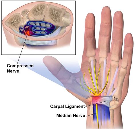 Carpal Tunnel Syndrome Anatomy