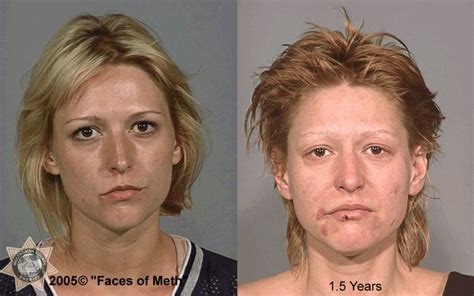 Health Info And Tips Drug Addicts Before And After