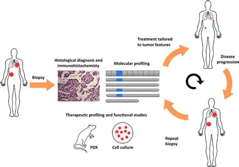 Precision Medicine In Lung Cancer Challenges And Opportunities In