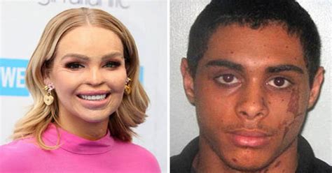 Strictlys Katie Piper Vows To Stay Calm As Acid Attacker Freed From Jail Daily Star
