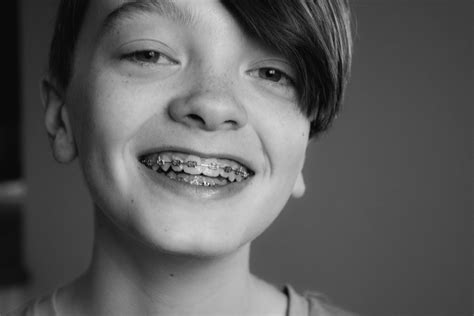 What Is The Best Age To Get Braces Boston Herald Boston News
