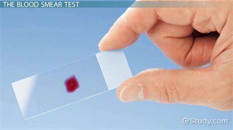 Blood Smear Staining Procedure