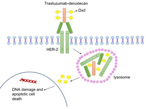 Trastuzumab Deruxtecan For Metastatic Her2 Low Breast Cancer Nci