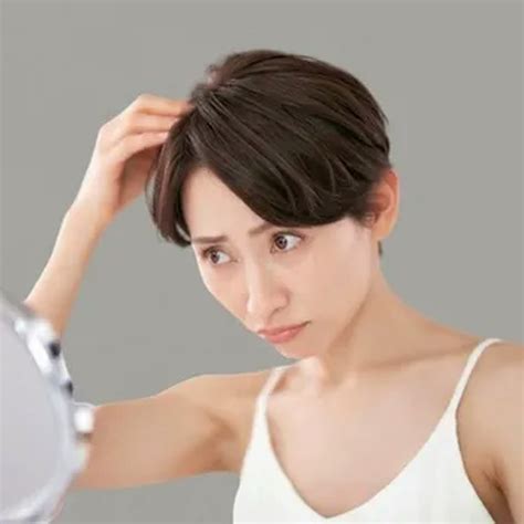 17 Cara Mengatasi Ketombe Parah, Kering, dan Basah | All Things Beauty