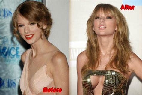 People Are Freaking Out Over Taylor Swifts Boob Job Yourtango