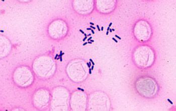Listeria monocytogenes in dairy products, seafoods, and meats. Listeria monocytogenes