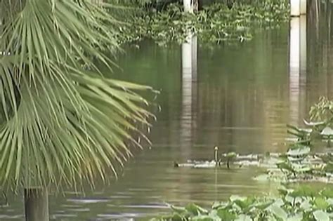 Alligator Bites Off Womans Arm As She Swam In River